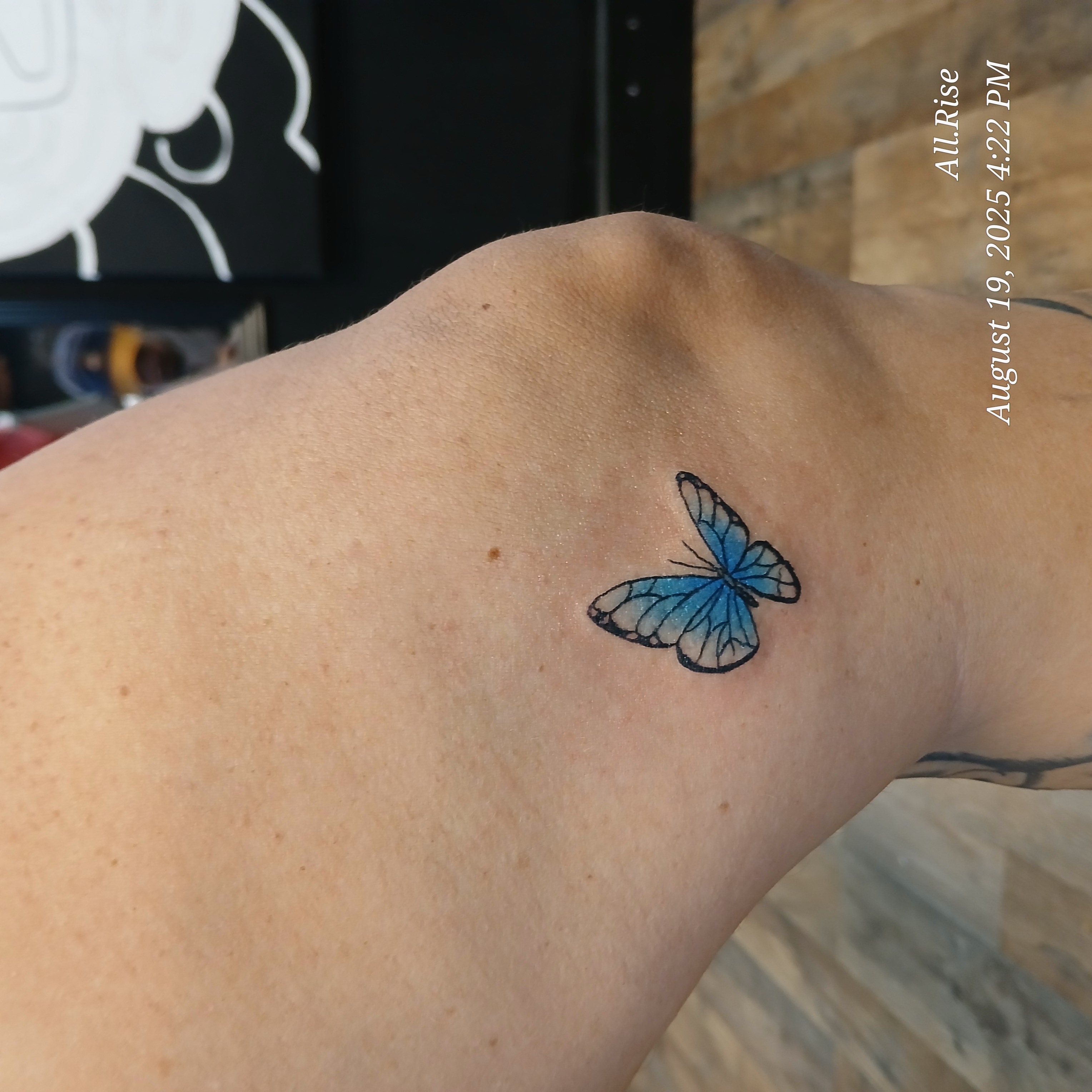 Little 🦋 on the knee